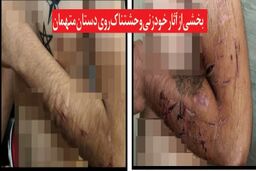 حمله خونین به مرد پاکبان برای دزدیدن موتور