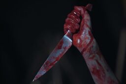 بازگشت از یک قدمی مرگ با 10 ضربه چاقو، انگیزه مرموز از حمله خشن به مرد معتاد