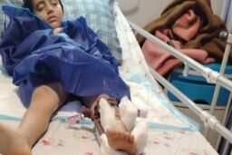 جزئیات ضرب و جرح شدید کودک دانش‌آموز از سوی ناظم مدرسه