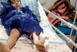 جزئیات ضرب و جرح شدید کودک دانش‌آموز از سوی ناظم مدرسه