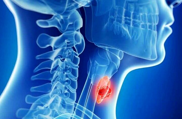 بهترین مواد غذایی برای نجات تیروئید