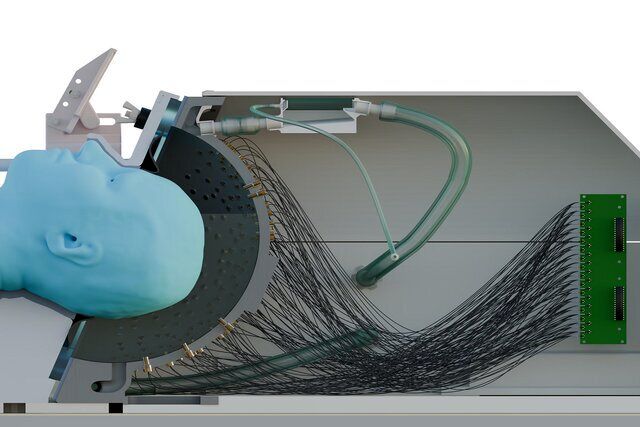 کشف روش جدید برای درمان پارکینسون