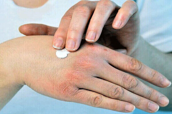 راهکارهای ساده برای جلوگیری از خشکی پوست در پاییز